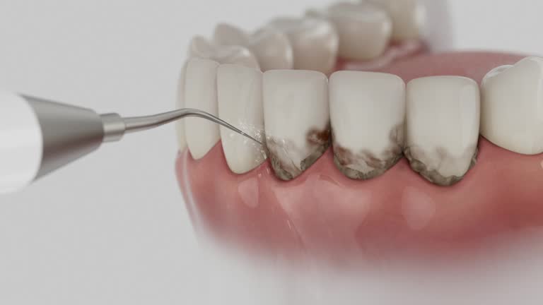 Reliable Dental Implants contractor in Amboy, IL by Smile Center Dentistry